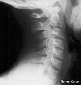 normal c spine xray