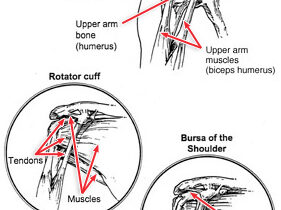 Rotator Cuff Injuries and Shoulder Pain